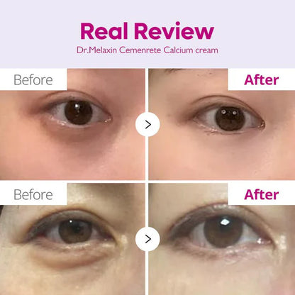 Clinclii™  Calcium Dark Spot Eye Cream
