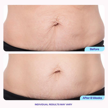 Firmer-Looking, Smoother Skin—Made Simple