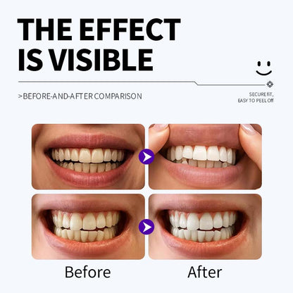 Whitening Strips
