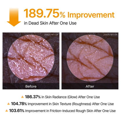 Clinclii™Acid Turmeric Exfoliating Cleaning Spray